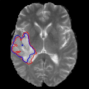 Wire media illustration